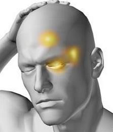 Cefalea a Grappolo: Il mal di testa al maschile Caratterizzata da un dolore lancinante e trafittivo attorno ad un occhio o a uno zigomo Si accompagna spesso