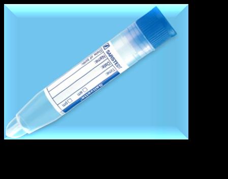 Prelievo di saliva Trattamento del campione, tecniche di estrazione come altre matrici biologiche. Fluidificazione. Elettroforesi di proteine e separazione di frazioni specifiche.