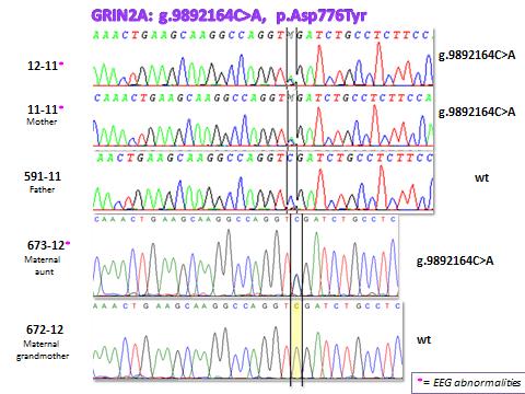 M.M., nato il 03/10/05, 12-11 Il Sequenziamento Sanger conferma la mutazione in GRIN2A nel probando (IV-1, 12-11), nella madre affetta (III-3,