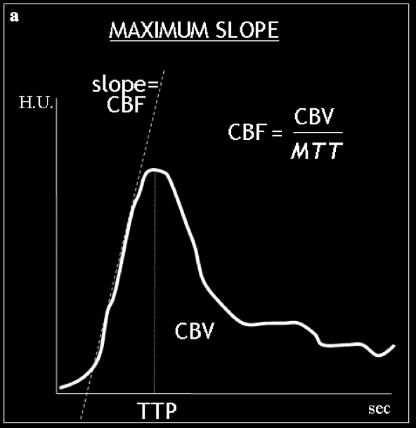 Il modello del maximum slope calcola il CBV integrando l area sotto la curva densità/tempo, il CBF secondo la tangente alla porzione ascendente