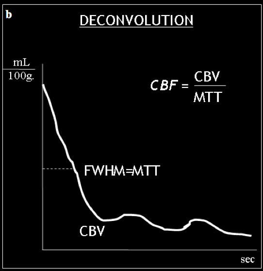 Il modello di deconvolution, tramite un arterial input function, trasforma la curva densità/tempo in una curva di funzione tissutale, in cui l integrale dell area sotto la curva esprime il CBV, il