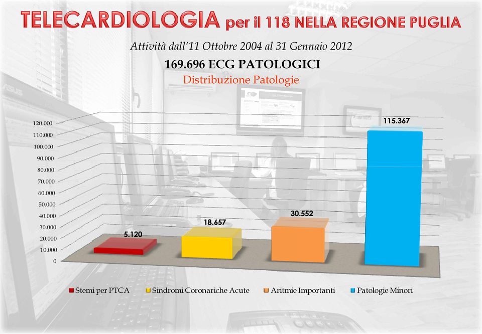 ............... Stemi per PTCA Sindromi