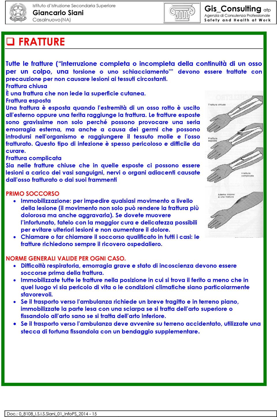 Frattura esposta Una frattura è esposta quando l'estremità di un osso rotto è uscito all'esterno oppure una ferita raggiunge la frattura.