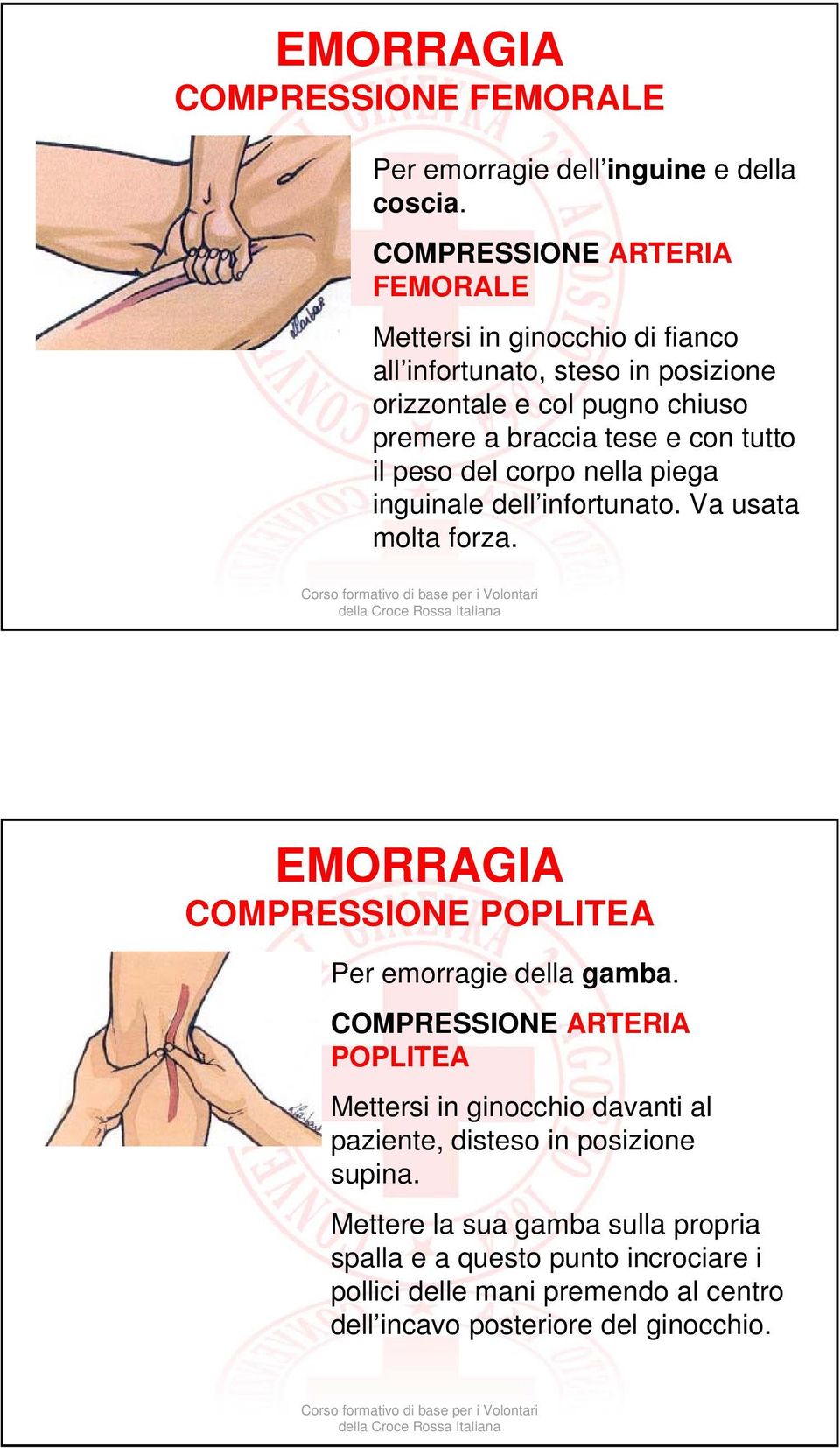 con tutto il peso del corpo nella piega inguinale dell infortunato. Va usata molta forza. EMORRAGIA COMPRESSIONE POPLITEA Per emorragie della gamba.