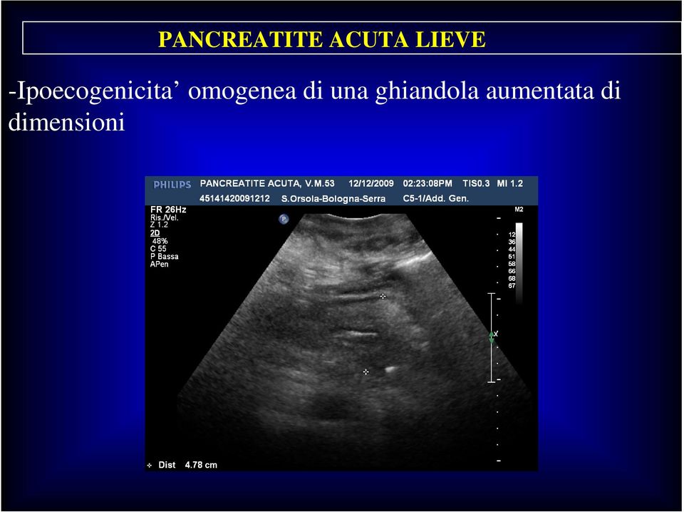 omogenea di una