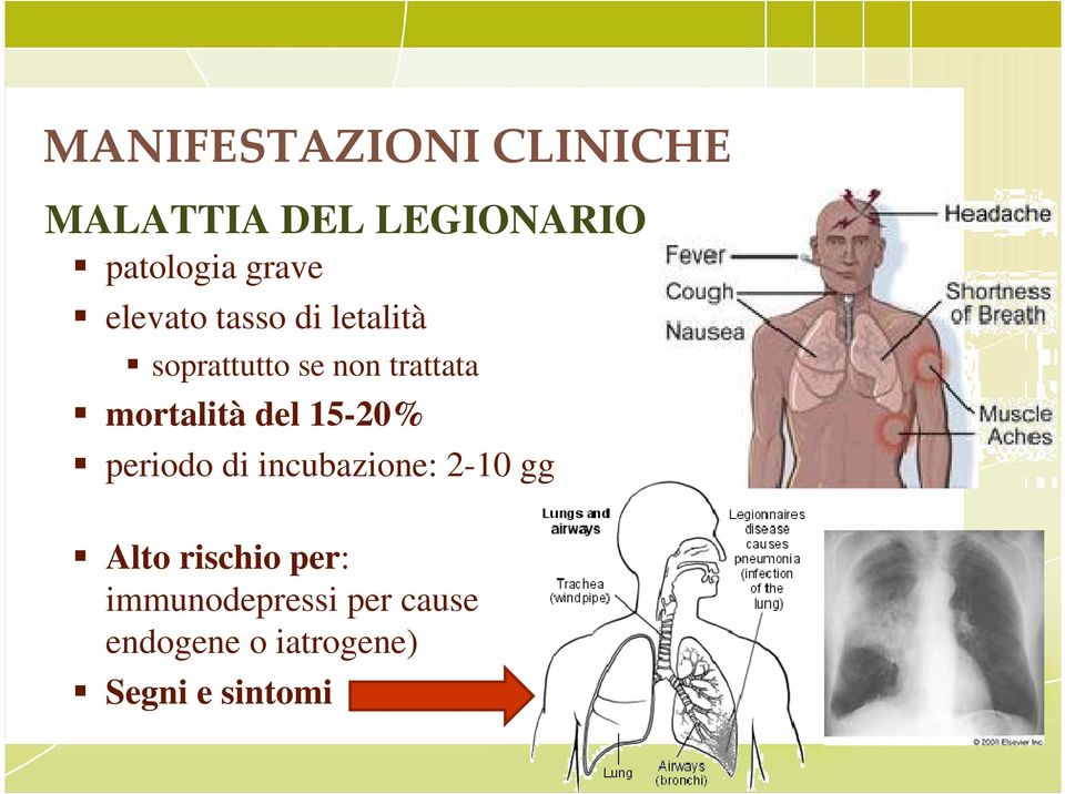 mortalità del 15-20% periodo di incubazione: 2-10 gg Alto