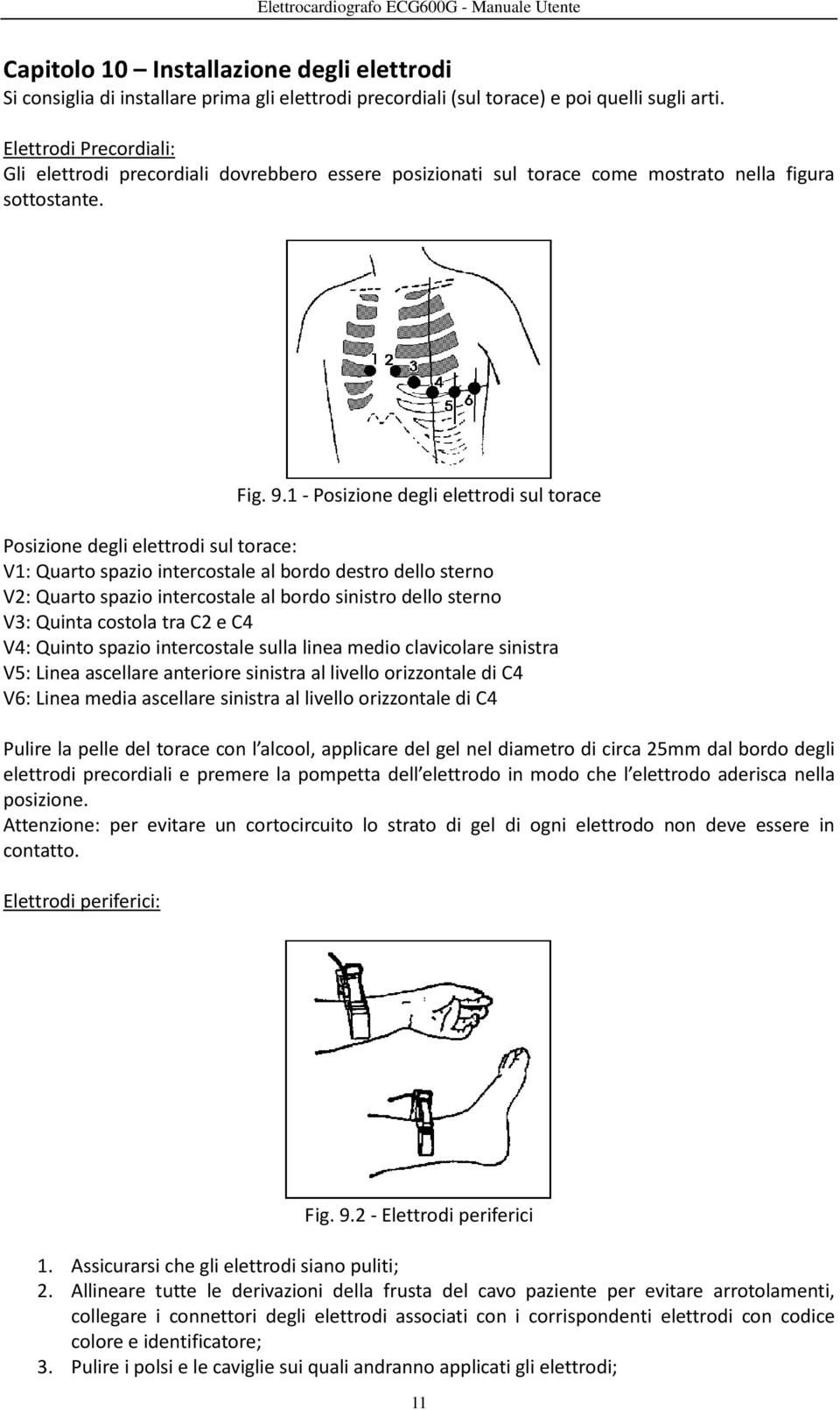 1 - Posizione degli elettrodi sul torace Posizione degli elettrodi sul torace: V1: Quarto spazio intercostale al bordo destro dello sterno V2: Quarto spazio intercostale al bordo sinistro dello