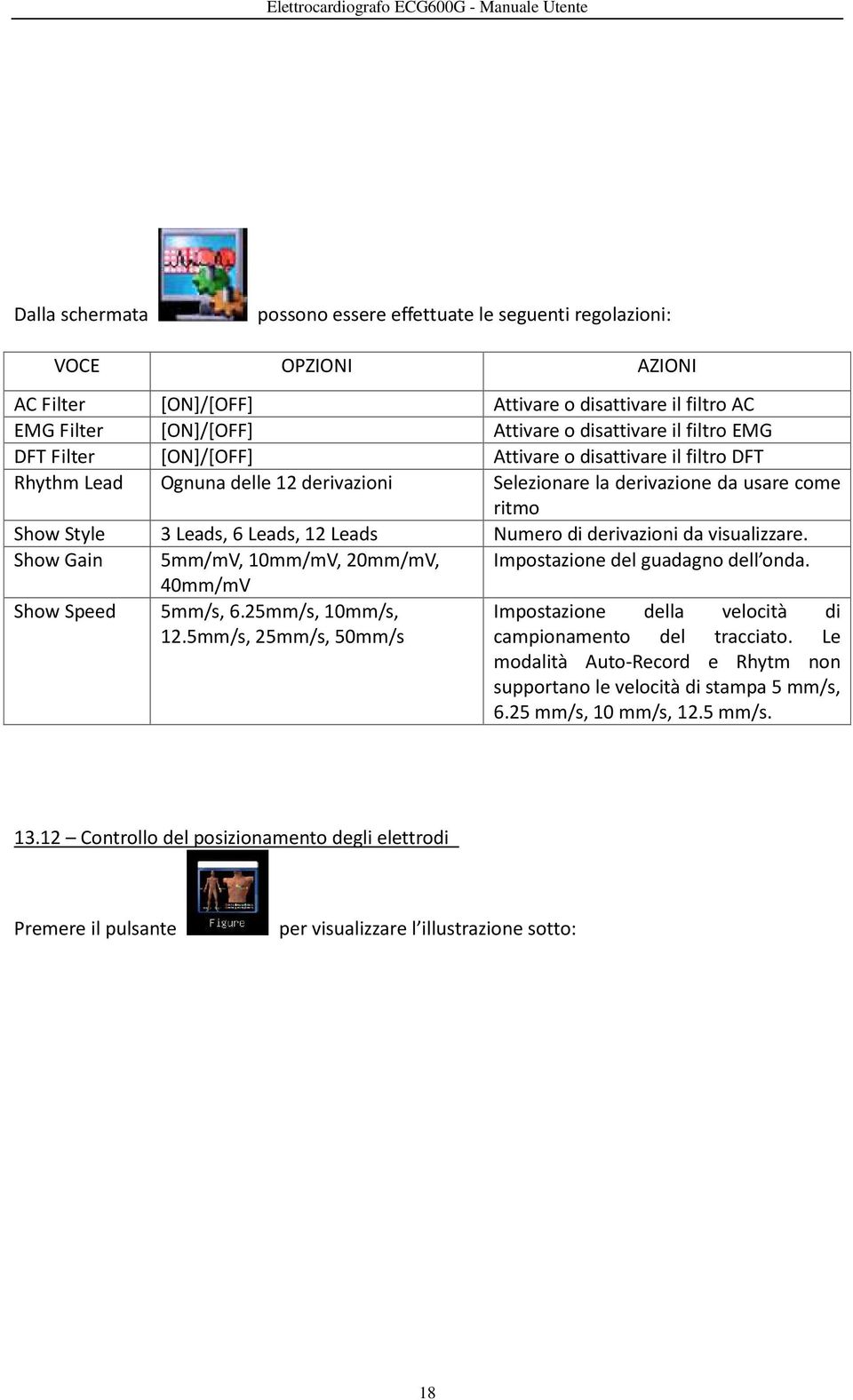 derivazioni da visualizzare. Show Gain 5mm/mV, 10mm/mV, 20mm/mV, Impostazione del guadagno dell onda. Show Speed 40mm/mV 5mm/s, 6.25mm/s, 10mm/s, 12.