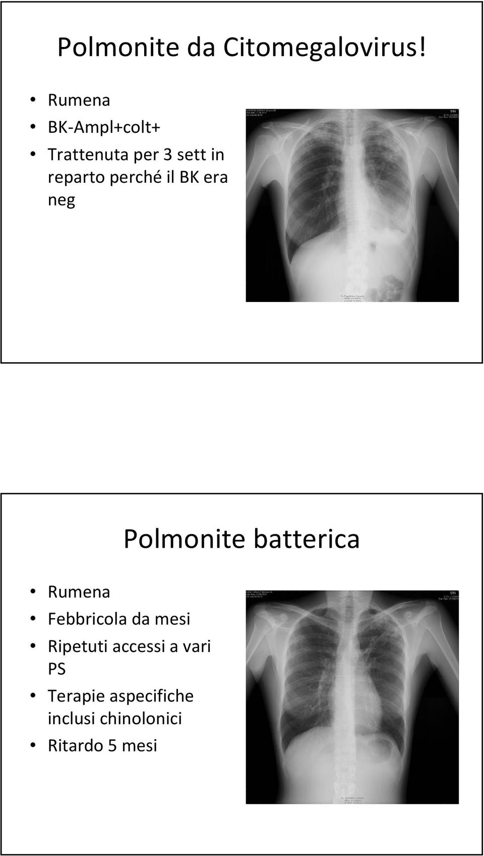 perchéil BK era neg Polmonite batterica Rumena Febbricola