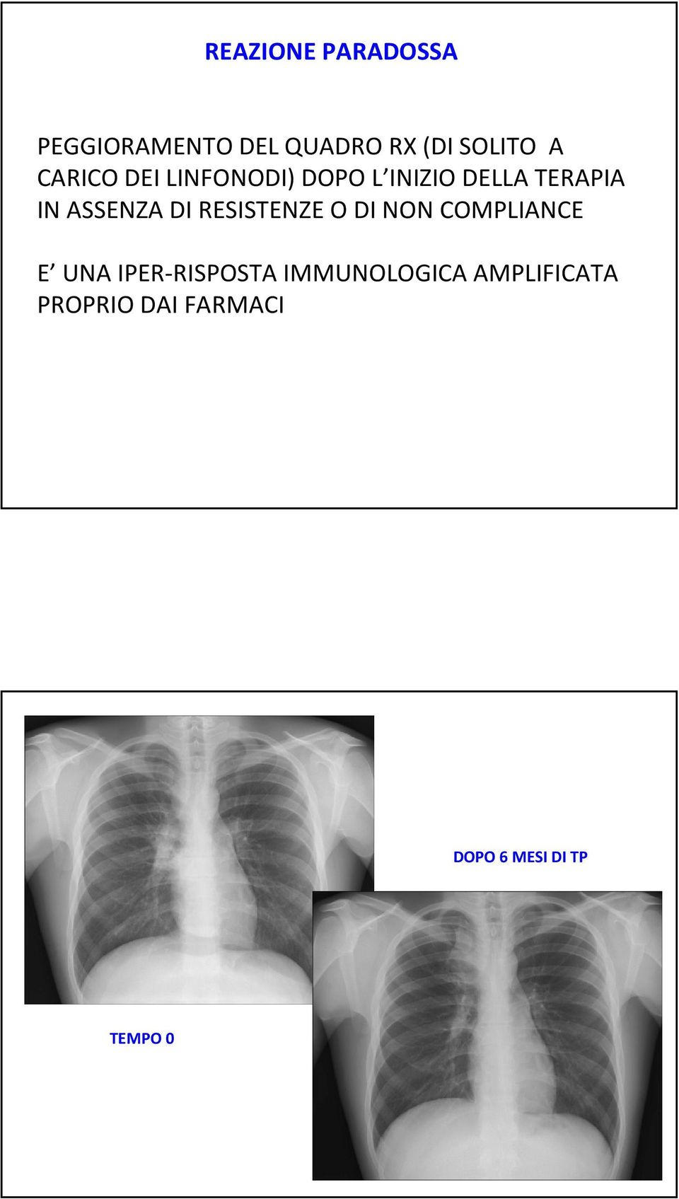 DI RESISTENZE O DI NON COMPLIANCE E UNA IPER-RISPOSTA