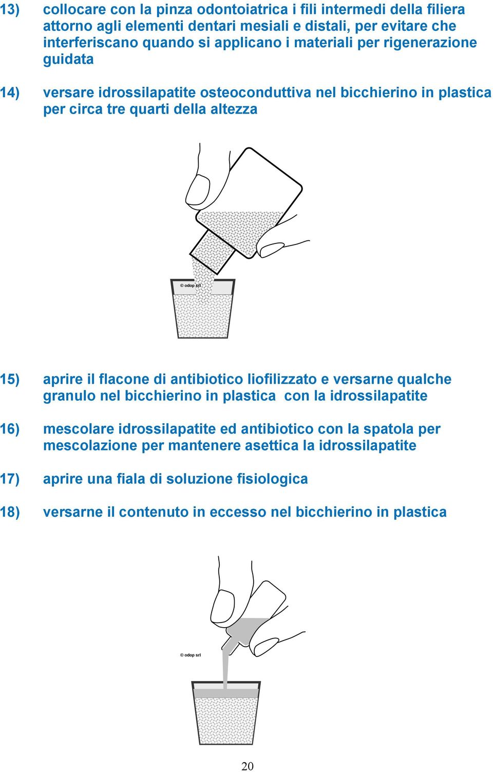 flacone di antibiotico liofilizzato e versarne qualche granulo nel bicchierino in plastica con la idrossilapatite 16) mescolare idrossilapatite ed antibiotico con la