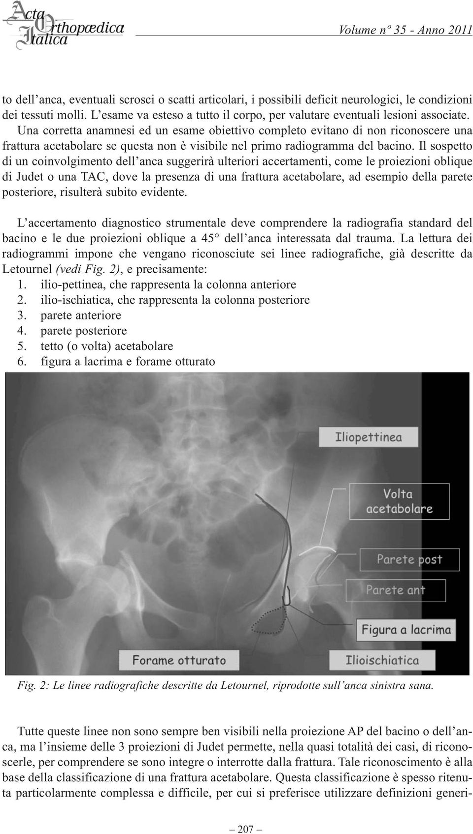 Il sospetto di un coinvolgimento dell anca suggerirà ulteriori accertamenti, come le proiezioni oblique di Judet o una TAC, dove la presenza di una frattura acetabolare, ad esempio della parete