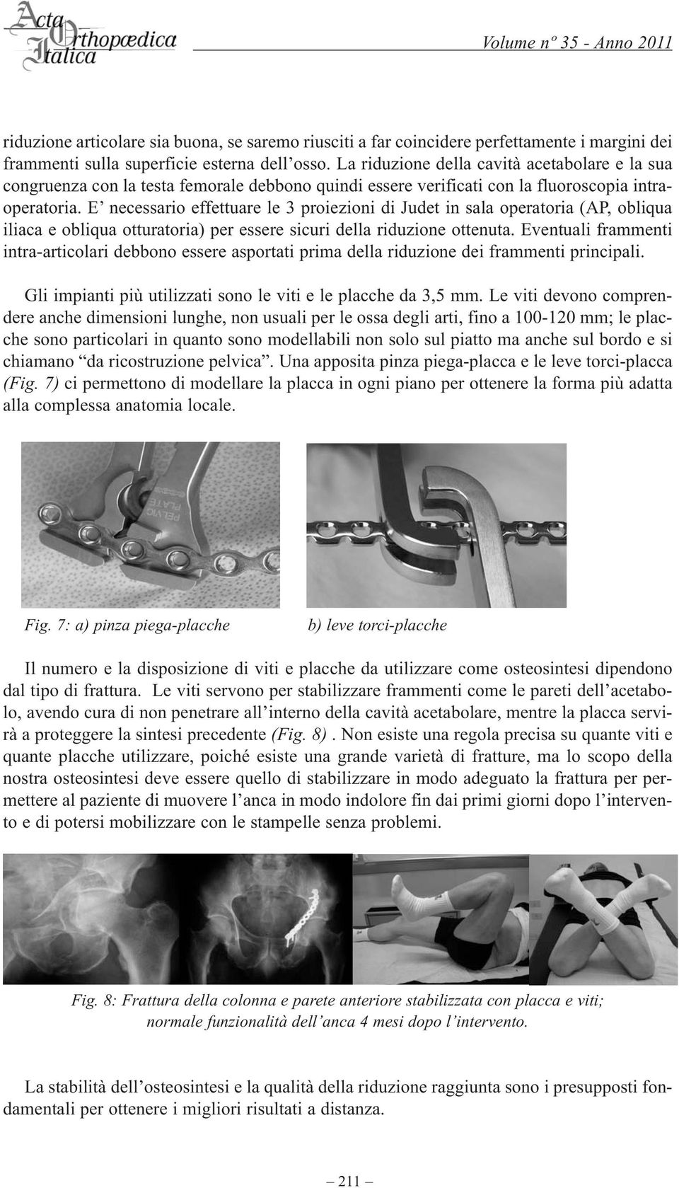 E necessario effettuare le 3 proiezioni di Judet in sala operatoria (AP, obliqua iliaca e obliqua otturatoria) per essere sicuri della riduzione ottenuta.