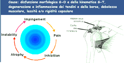 Sindrome da conflitto Disturbo doloroso causato