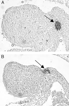 La morfogenesi tiroidea fetale precede la sintesi ormonale De Felice & Di Lauro, Endocrine Reviews