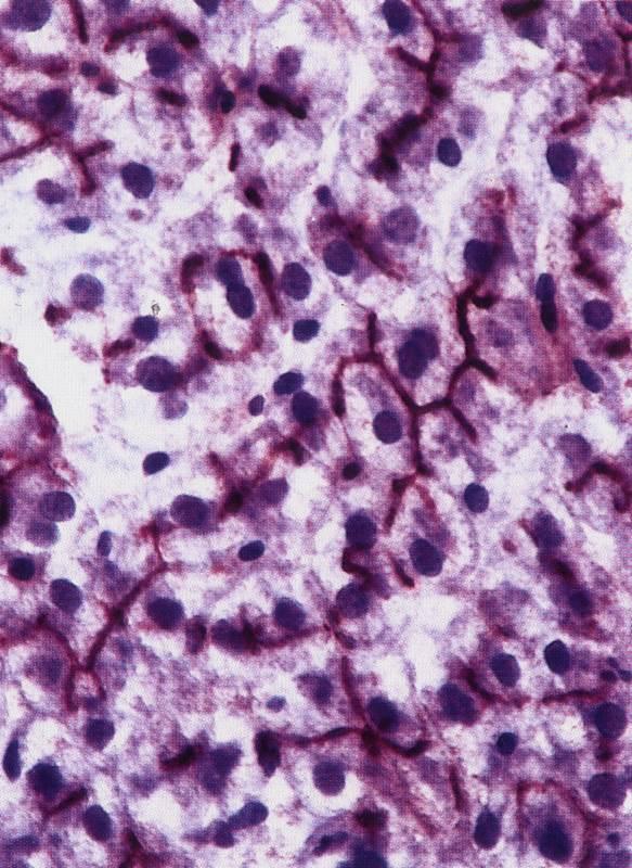 Acino complesso Epatociti, multifunzionali Produzione esocrina Bile La bile