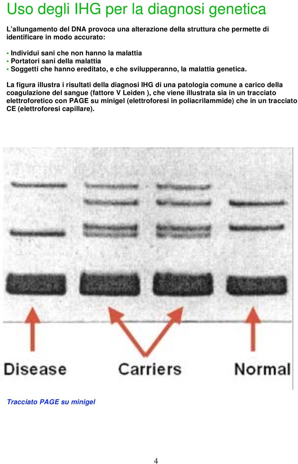 La figura illustra i risultati della diagnosi IHG di una patologia comune a carico della coagulazione del sangue (fattore V Leiden ), che viene