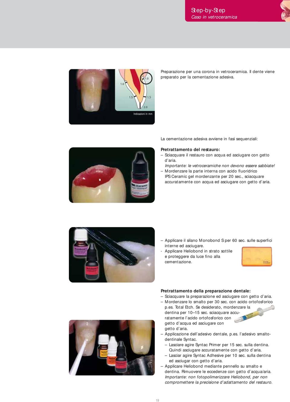 Importante: le vetroceramiche non devono essere sabbiate! Mordenzare la parte interna con acido fluoridrico IPS Ceramic gel mordenzante per 20 sec.