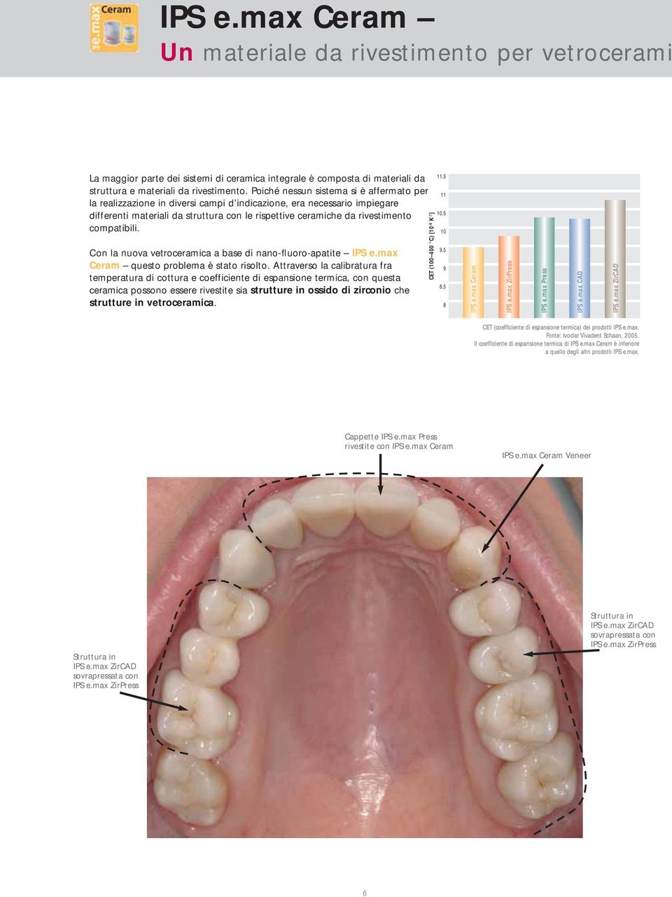 compatibili. Con la nuova vetroceramica a base di nano-fluoro-apatite IPS e.max Ceram questo problema è stato risolto.