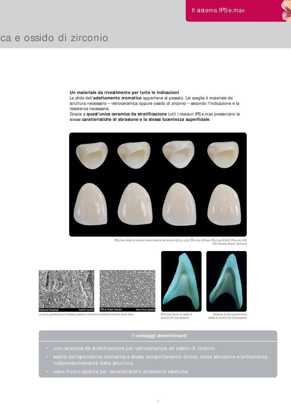 Grazie a quest unica ceramica da stratificazione tutti i restauri IPS e.max presentano le stesse caratteristiche di abrasione e la stessa lucentezza superficiale. IPS e.max Ceram su quattro diversi materiali da struttura (da sx.