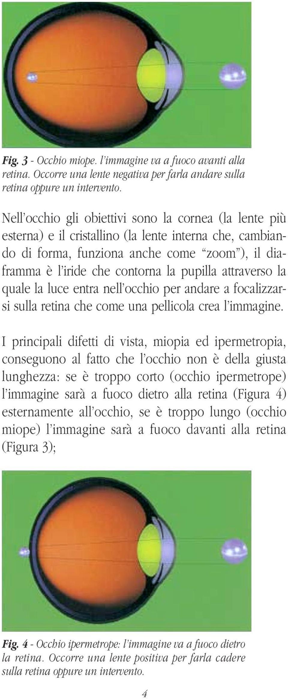 attraverso la quale la luce entra nell occhio per andare a focalizzarsi sulla retina che come una pellicola crea l immagine.