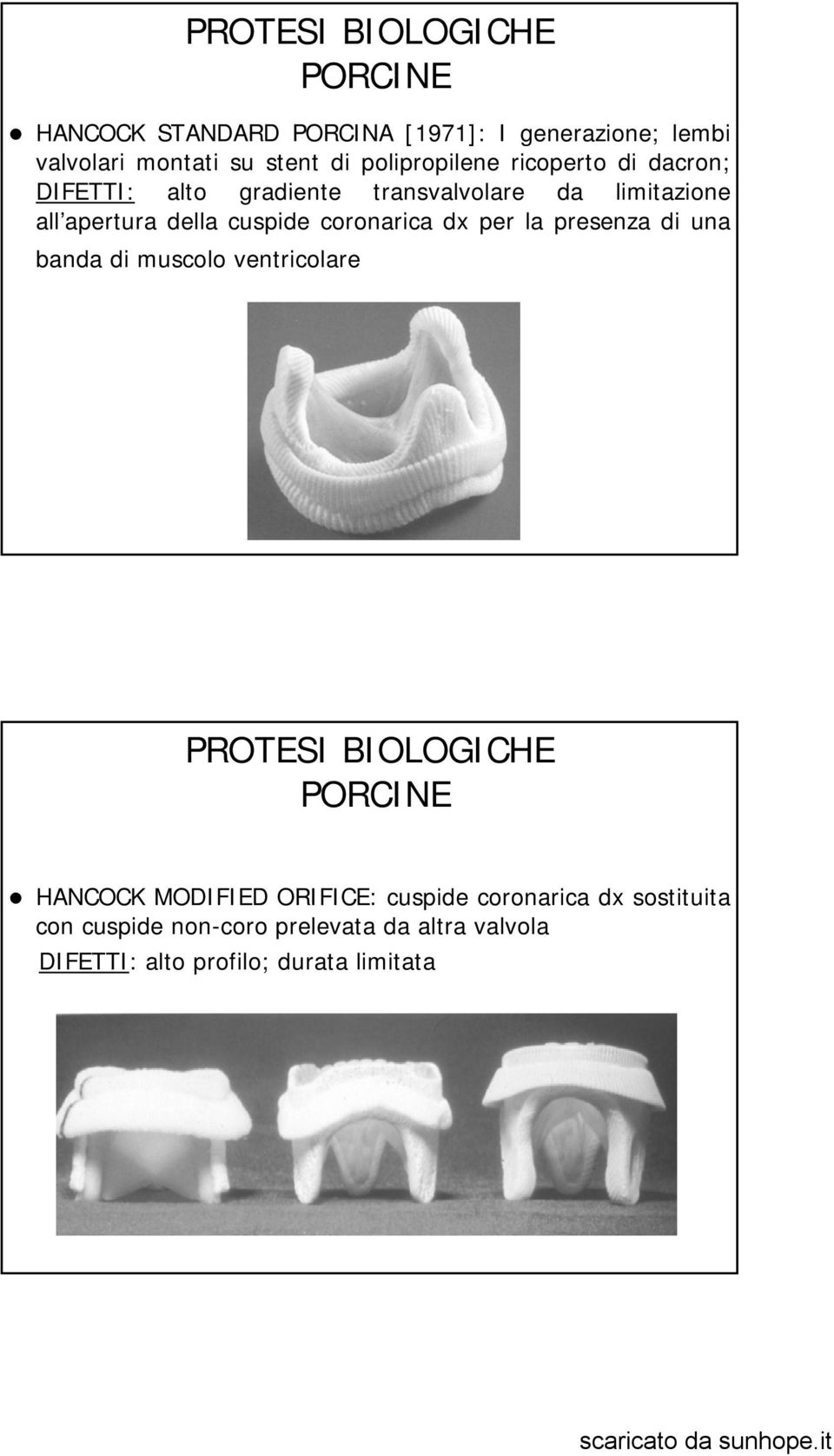 coronarica dx per la presenza di una banda di muscolo ventricolare PORCINE HANCOCK MODIFIED ORIFICE: