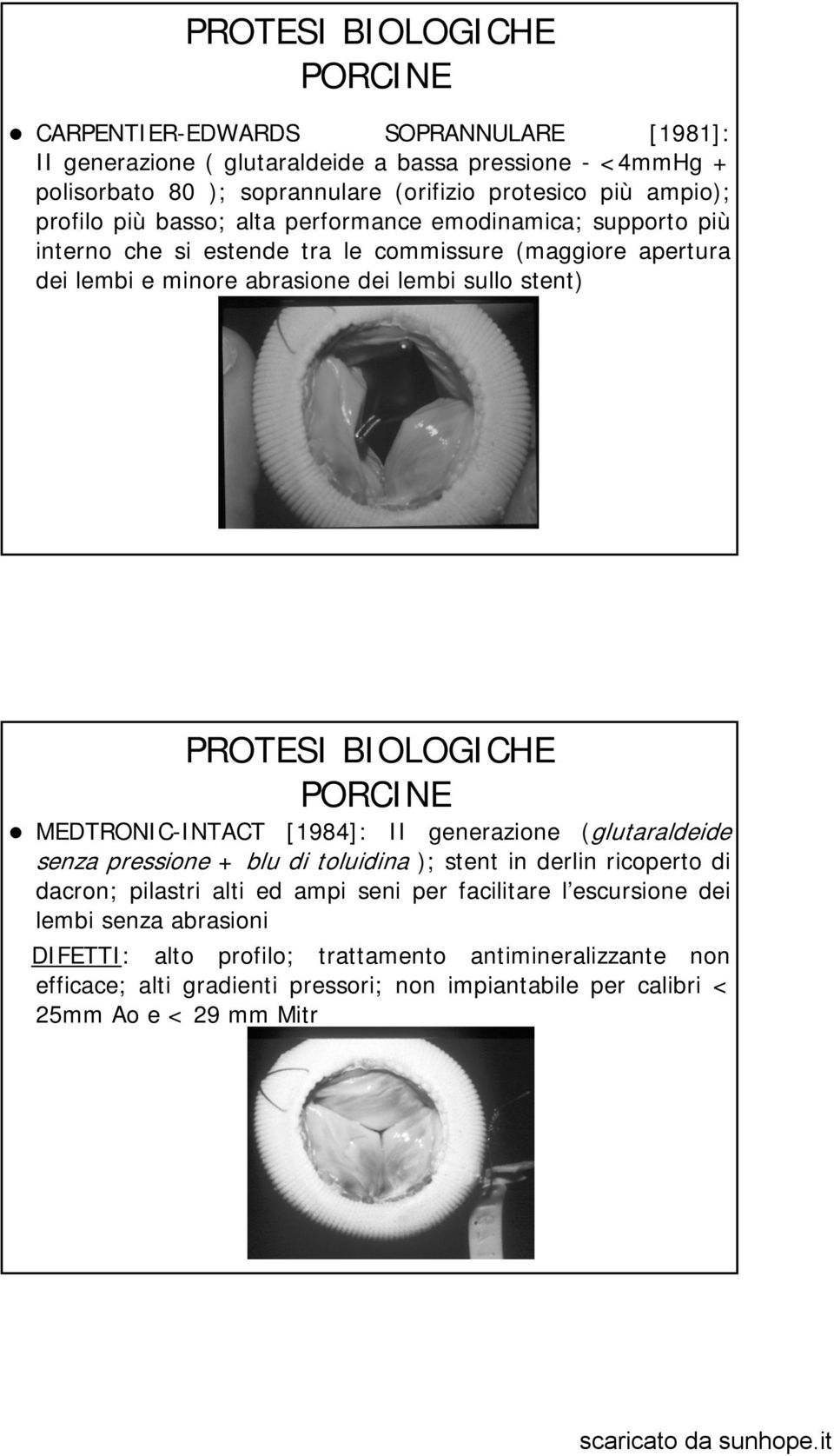 PORCINE MEDTRONIC-INTACT [1984]: II generazione (glutaraldeide senza pressione + blu di toluidina ); stent in derlin ricoperto di dacron; pilastri alti ed ampi seni per