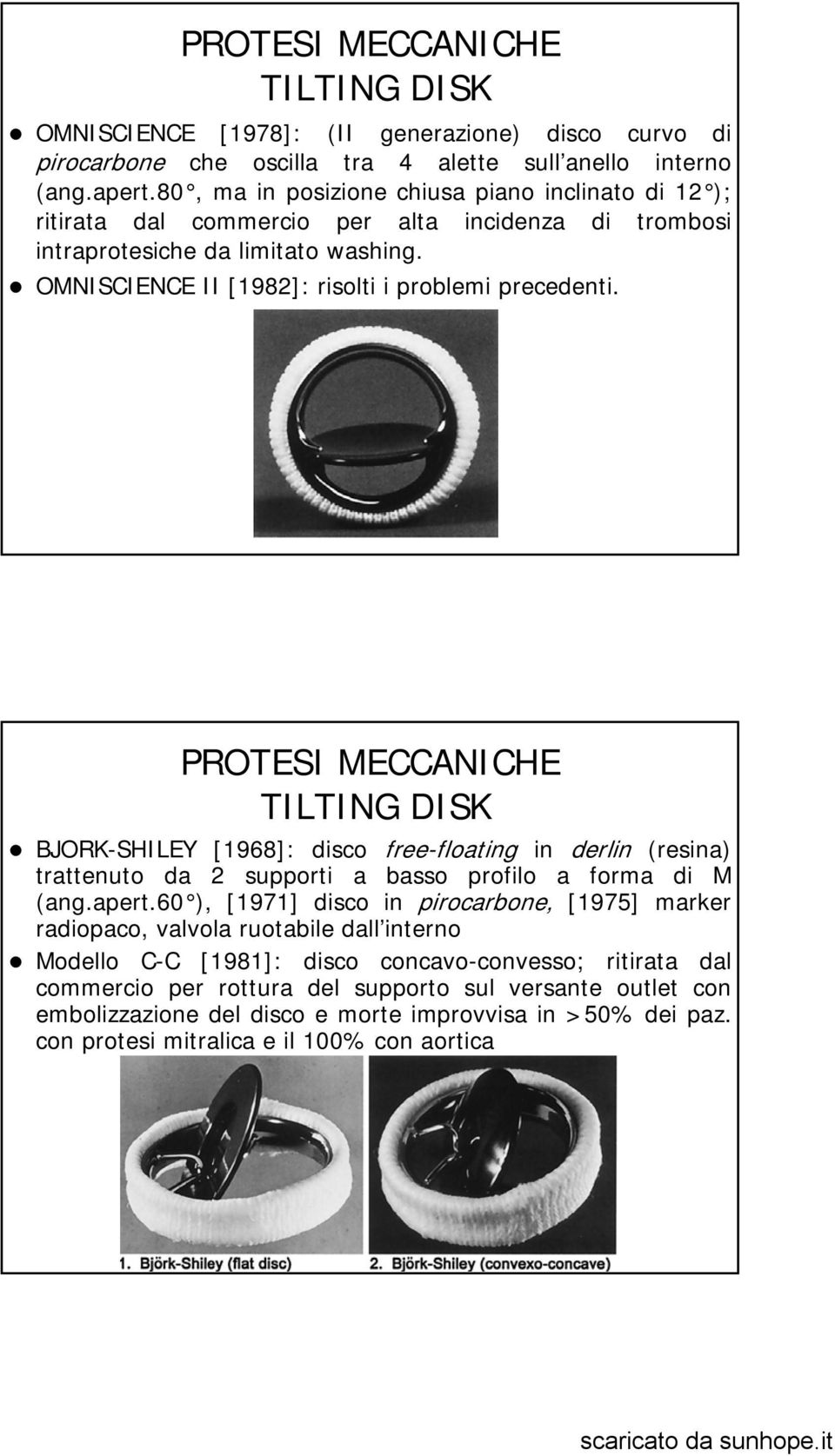 PROTESI MECCANICHE TILTING DISK BJORK-SHILEY [1968]: disco free-floating in derlin (resina) trattenuto da 2 supporti a basso profilo a forma di M (ang.apert.