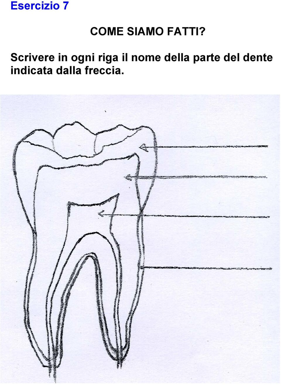 della parte del dente indicata