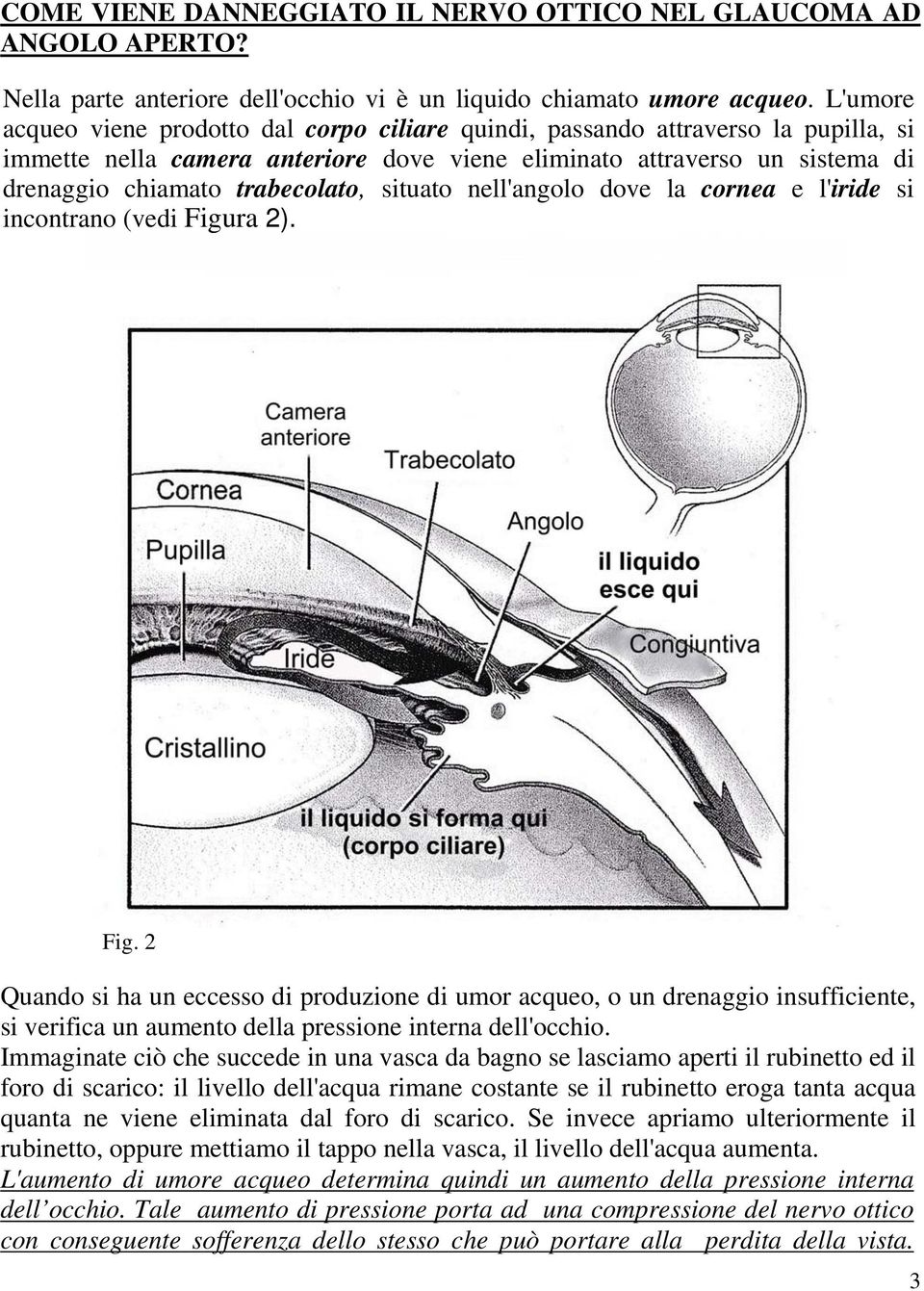 situato nell'angolo dove la cornea e l'iride si incontrano (vedi Figu