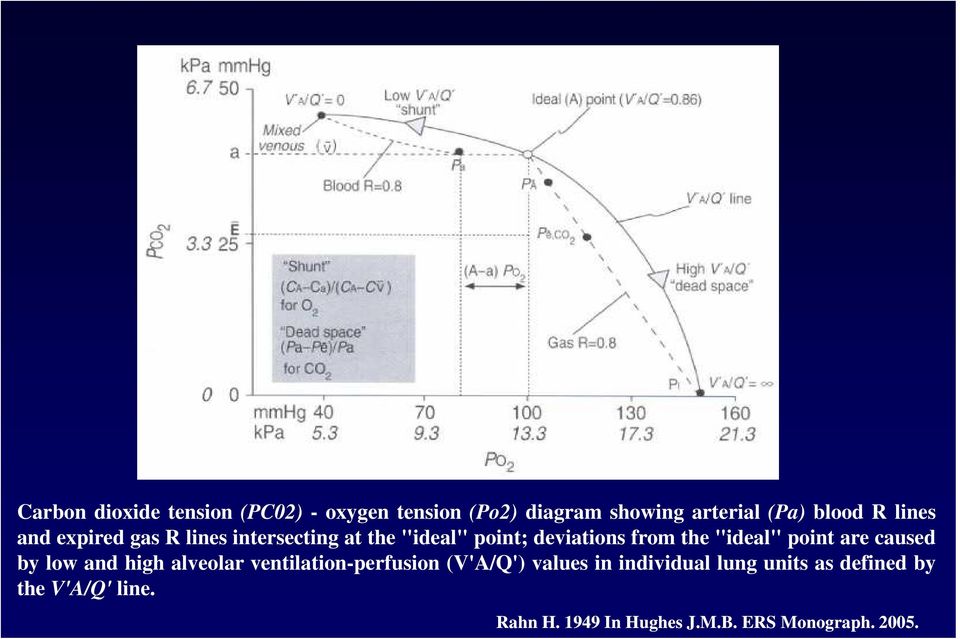 point are caused by low and high alveolar ventilation-perfusion (V'A/Q') values in