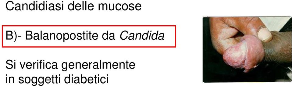 Candida Si verifica