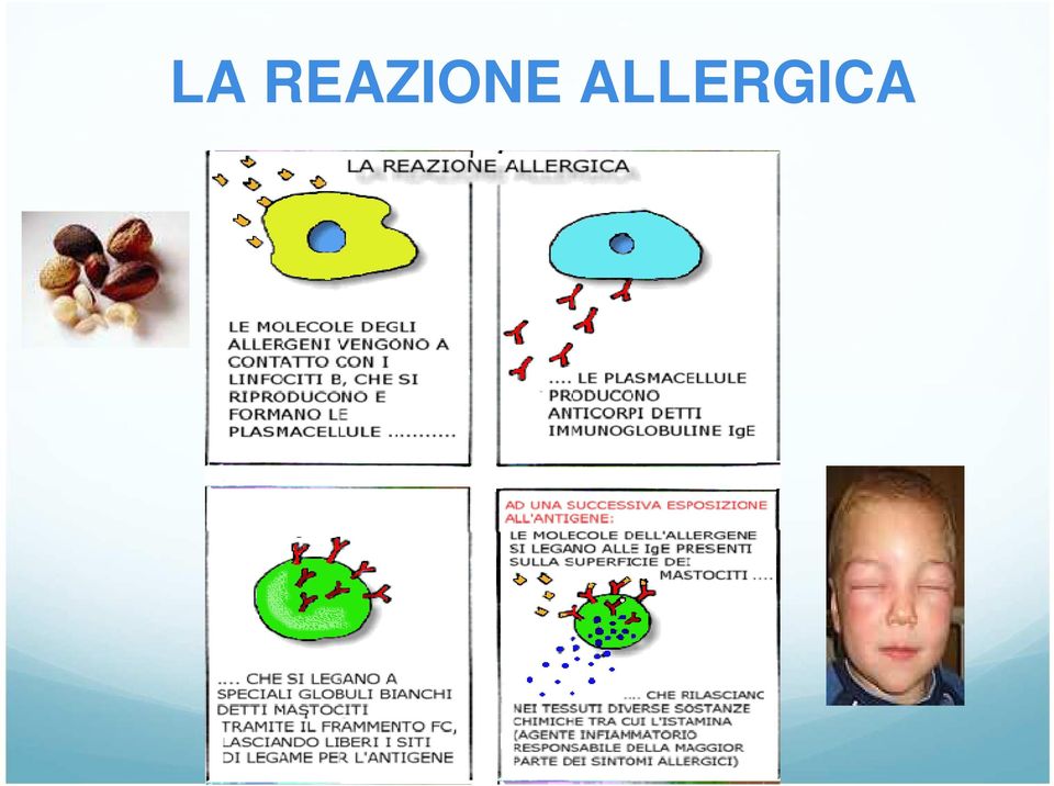 ALLERGICA