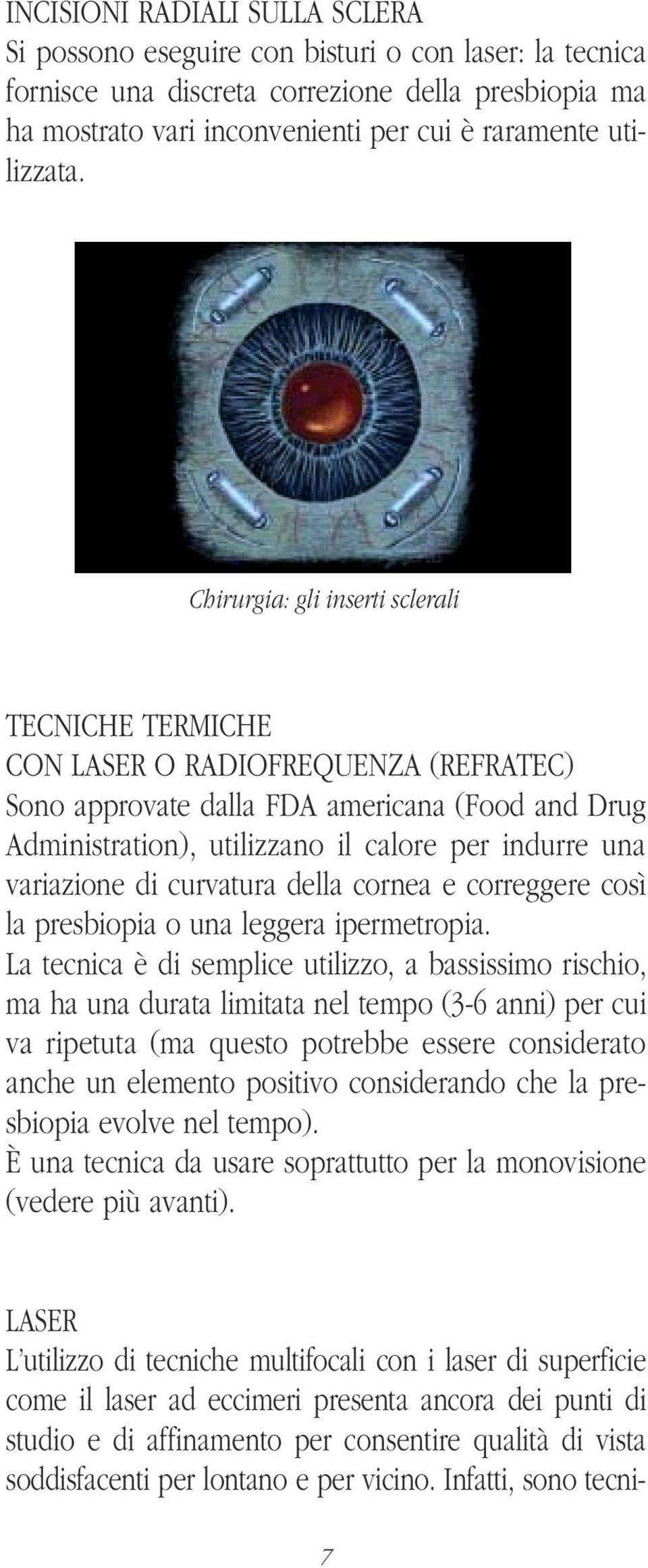 Chirurgia: gli inserti sclerali TECNICHE TERMICHE CON LASER O RADIOFREQUENZA (REFRATEC) Sono approvate dalla FDA americana (Food and Drug Administration), utilizzano il calore per indurre una