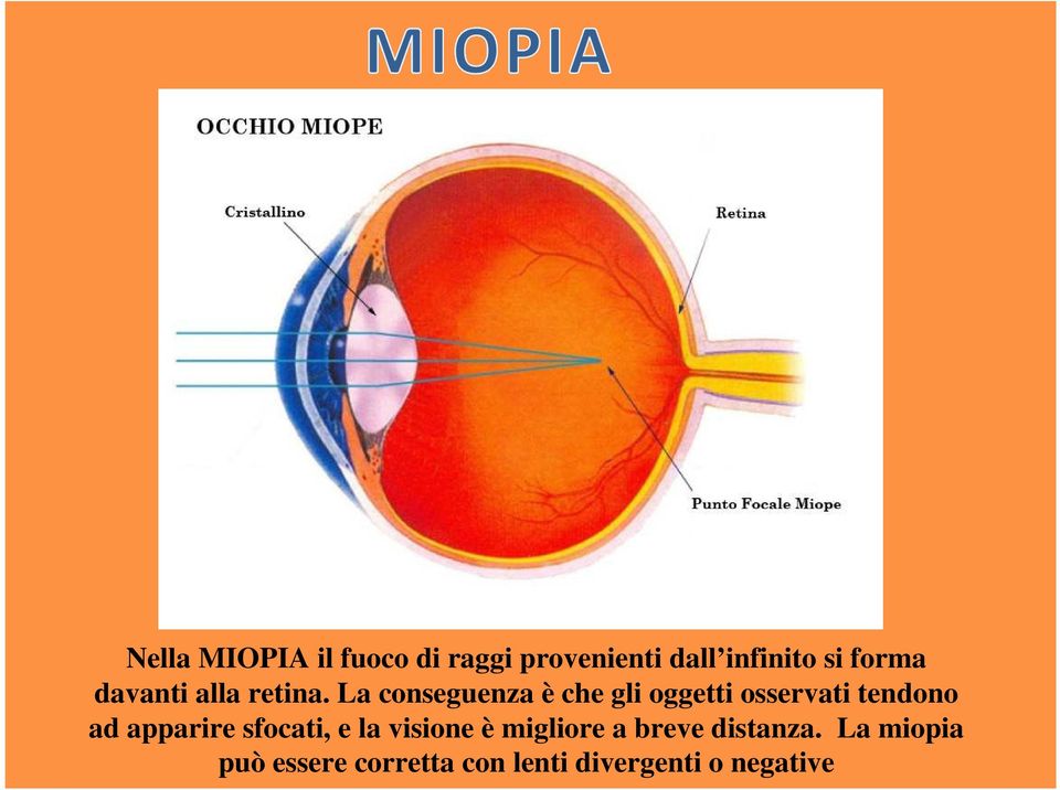 La conseguenza è che gli oggetti osservati tendono ad apparire