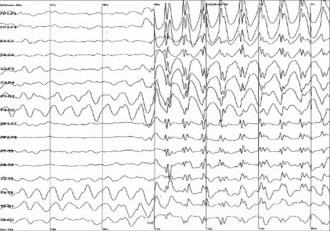 anomalie semestrale/trimestrale se occorre controllare lesioni o neoformazioni