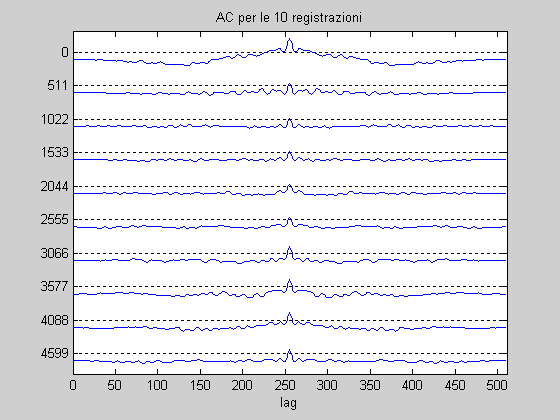 ES.4 MATLAB hrv.