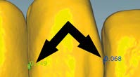 La catena dei denti anteriori superiori si muove in modo indipendente rispetto alla catena dei denti anteriori inferiori.