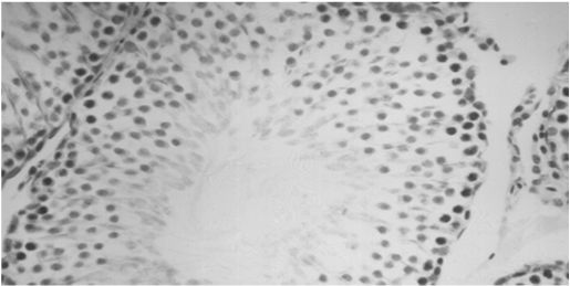 Risultati Aumento del numero delle cellule di Leydig nei ratti trattati rispetto ai controlli Risultati istologici