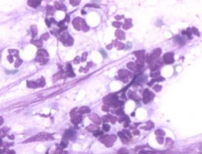 Distribuzione dei granulociti neutrofili Midollo Pool proliferativo Pool maturativo Pool di