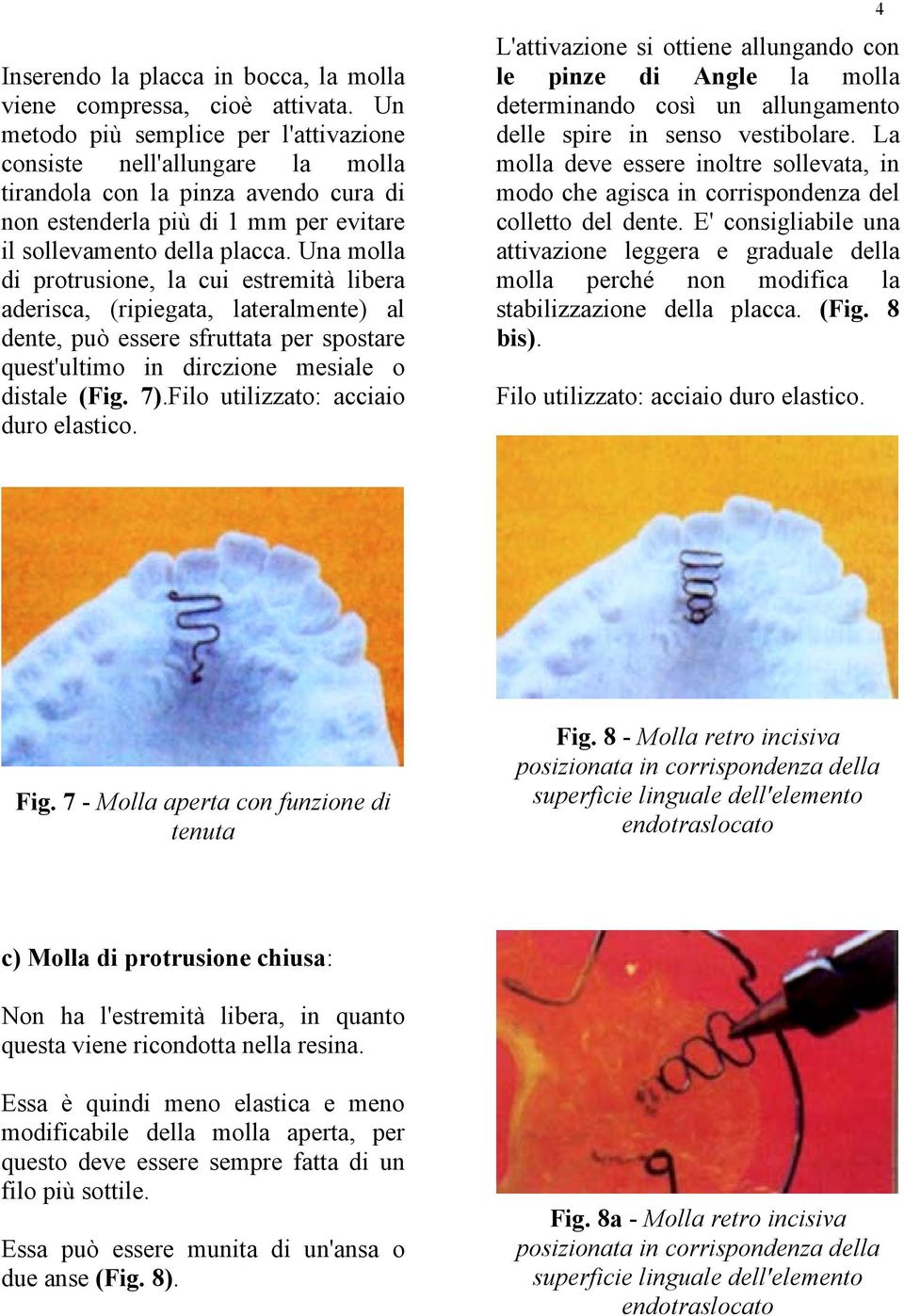 Una molla di protrusione, la cui estremità libera aderisca, (ripiegata, lateralmente) al dente, può essere sfruttata per spostare quest'ultimo in dirczione mesiale o distale (Fig. 7).