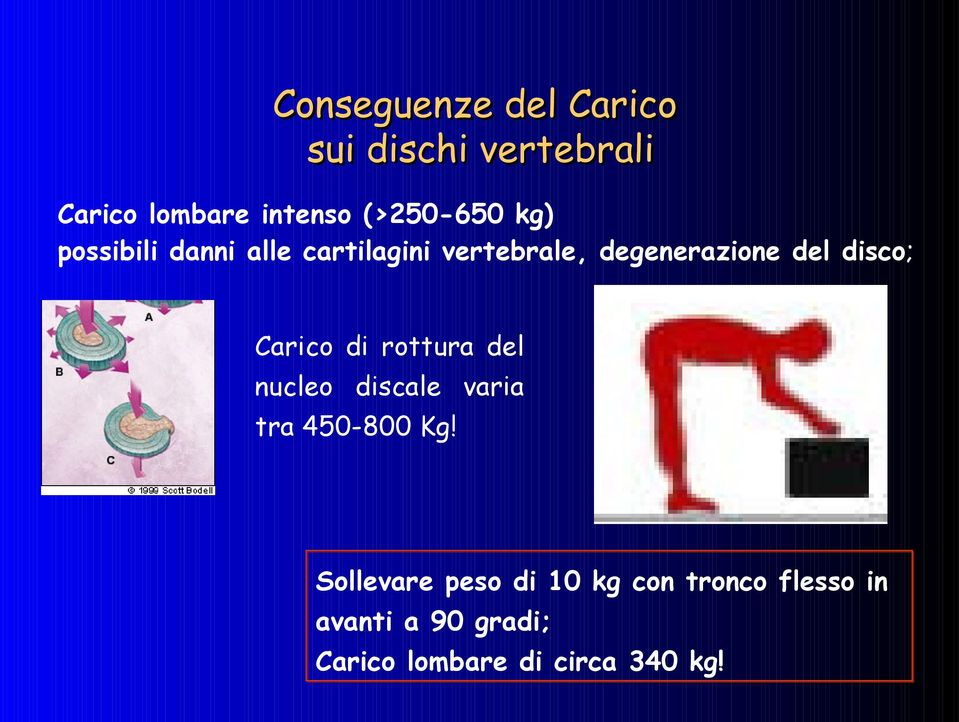 disco; Carico di rottura del nucleo discale varia tra 450-800 Kg!