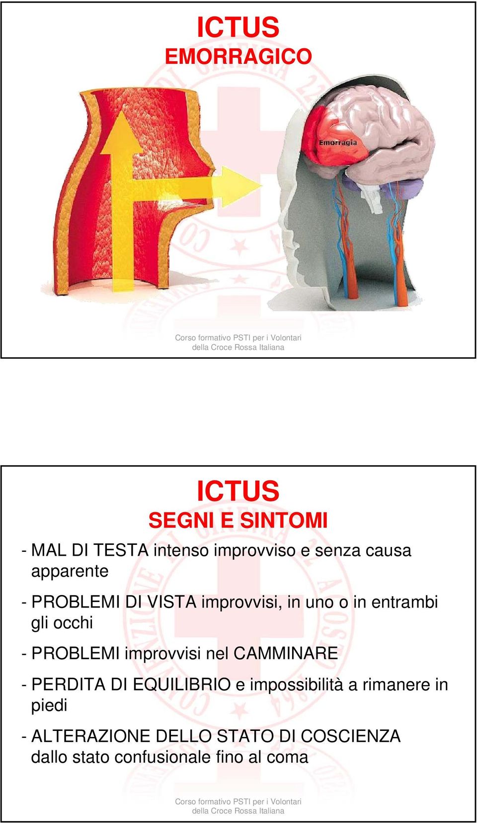 PROBLEMI improvvisi nel CAMMINARE - PERDITA DI EQUILIBRIO e impossibilità a