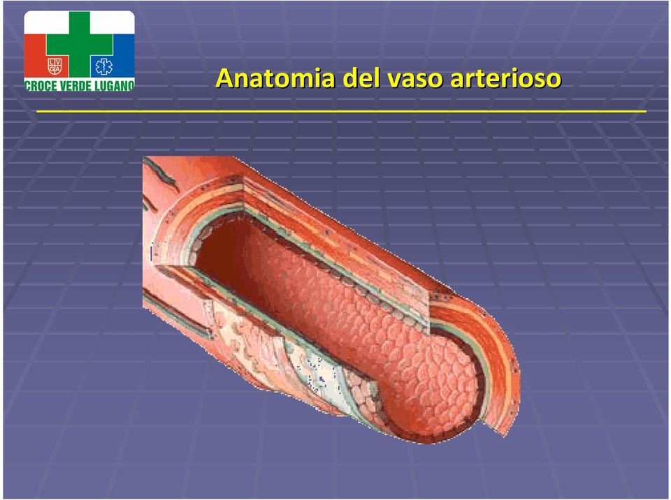 arterioso