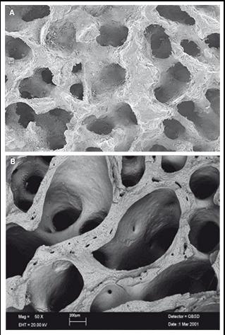 Fig.23 Biomimesi geometrica A) idrossiapatite porosa; B) osso spugnoso naturale.