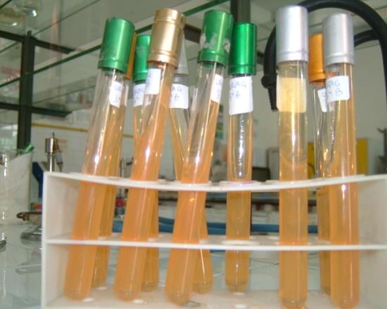 Coltura DIAGNOSI Il test colturale è considerato, in microbiologia, il "gold standard" diagnostico dell'infezione, ed è il solo metodo che permette lo studio della sensibilità batterica agli