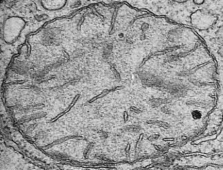 Mitocondri con diversa morfologia Condensati-alti livelli di