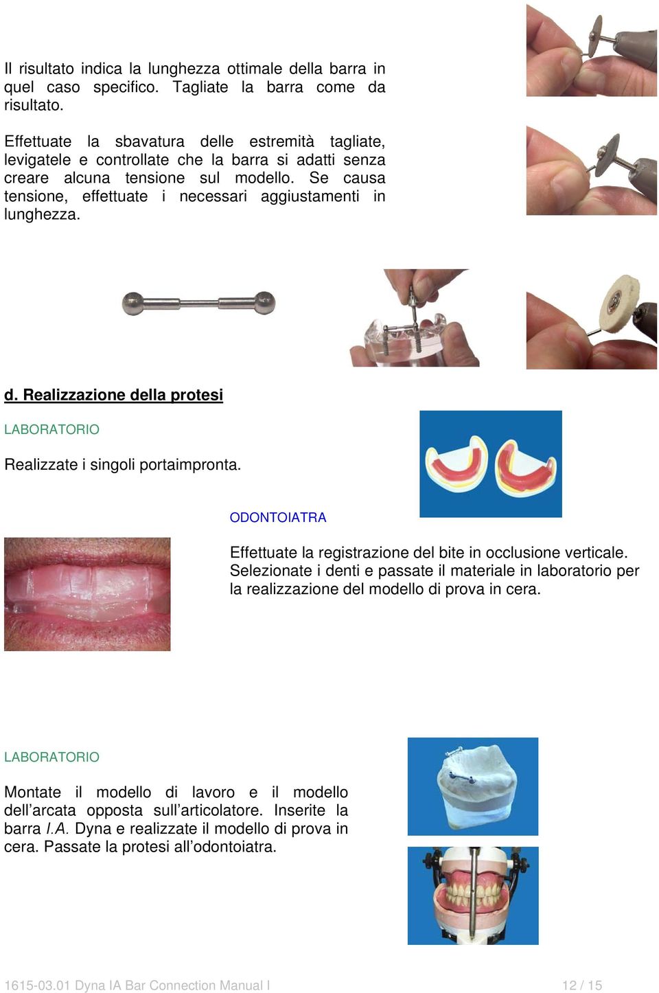 Se causa tensione, effettuate i necessari aggiustamenti in lunghezza. d. Realizzazione della protesi Realizzate i singoli portaimpronta. Effettuate la registrazione del bite in occlusione verticale.