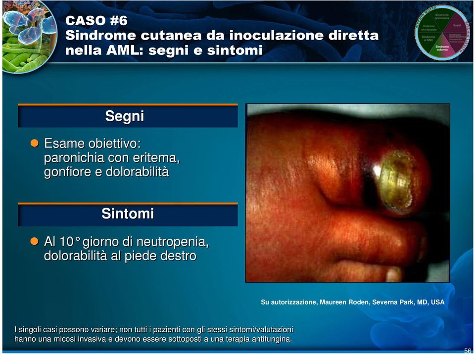 dolorabilità Sintomi Al 10 giorno di neutropenia, dolorabilità al