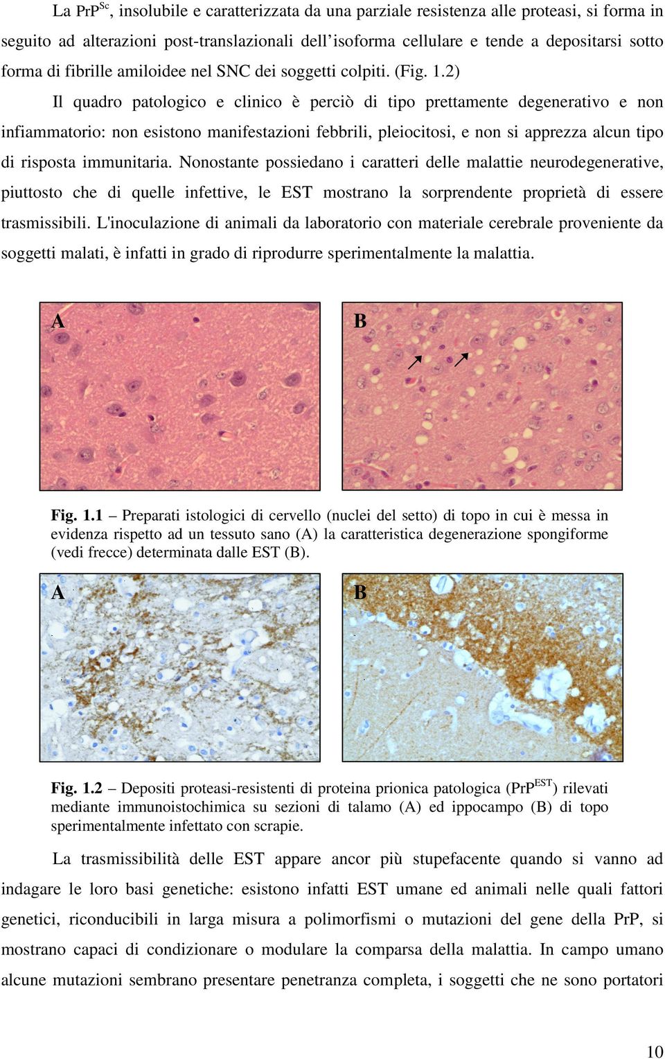 2) Il quadro patologico e clinico è perciò di tipo prettamente degenerativo e non infiammatorio: non esistono manifestazioni febbrili, pleiocitosi, e non si apprezza alcun tipo di risposta